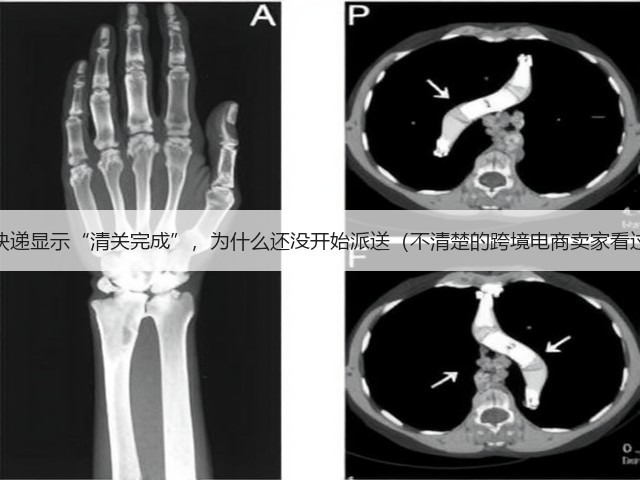 国际快递显示“清关完成”,为什么还没开始派送(不清楚的跨境电商卖家看过来)(图3) 国际快递显示“清关完成”,为什么还没开始派送(不清楚的跨境电商卖家看过来)(图3)