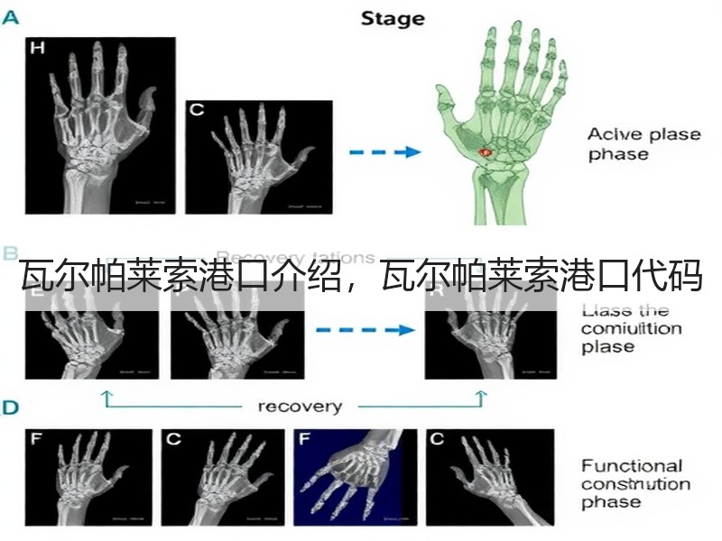 瓦尔帕莱索港口介绍,瓦尔帕莱索港口代码 瓦尔帕莱索港口介绍,瓦尔帕莱索港口代码